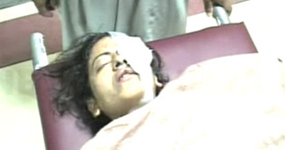 Islamabad: Estranged man throws acid on wife